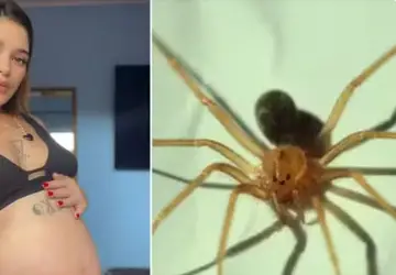 Grávida tem pele da perna necrosada após ser 'picada' por aranha venenosa